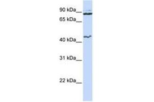Image no. 1 for anti-Minichromosome Maintenance Deficient 9 (MCM9) (N-Term) antibody (ABIN6742708) (MCM9 anticorps  (N-Term))