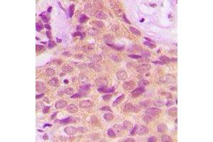 Immunohistochemistry (IHC) image for anti-Protein Phosphatase 2A Activator, Regulatory Subunit 4 (PPP2R4) antibody (ABIN7308210)