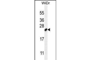 LOC147646 Antibody (C-term) (ABIN655852 and ABIN2850489) western blot analysis in WiDr cell line lysates (35 μg/lane). (C19orf84 anticorps  (C-Term))