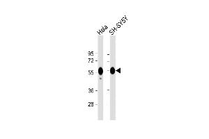All lanes : Anti-CALR Antibody at 1:1000 dilution Lane 1: Hela whole cell lysate Lane 2: SH-SY5Y whole cell lysate Lysates/proteins at 20 μg per lane. (Calreticulin anticorps)