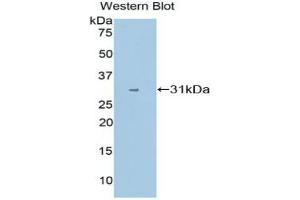 Western blot analysis of the recombinant protein. (CYP1A1 anticorps  (AA 1-250))