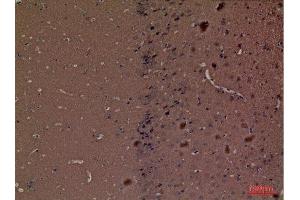 Immunohistochemistry (IHC) analysis of paraffin-embedded Mouse Brain, antibody was diluted at 1:100. (Hexosaminidase A anticorps  (Internal Region))