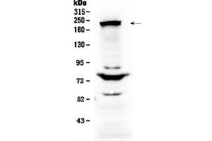 Western blot analysis of CHD2 using anti-CHD2 antibody . (CHD2 anticorps  (AA 1124-1351))