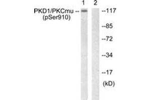 Western blot analysis of extracts from A431 cells, using PKD1/PKC mu (Phospho-Ser910) Antibody. (PKC mu anticorps  (pSer910))