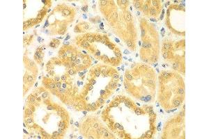 Immunohistochemistry of paraffin-embedded Human kidney using PDE4DIP Polyclonal Antibody at dilution of 1:100 (40x lens). (PDE4DIP anticorps)