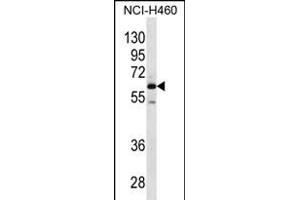 MEPE Antibody (N-term) (ABIN656329 and ABIN2845628) western blot analysis in NCI- cell line lysates (35 μg/lane). (MEPE anticorps  (N-Term))
