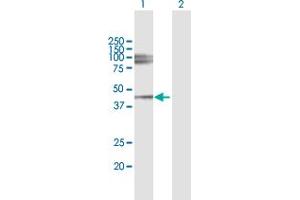 Western Blot analysis of LUM expression in transfected 293T cell line by LUM MaxPab polyclonal antibody. (LUM anticorps  (AA 1-338))