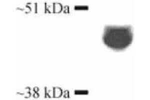 Image no. 1 for anti-Cytochrome P450, Family 3, Subfamily A, Polypeptide 4 (CYP3A4) antibody (Biotin) (ABIN230020)