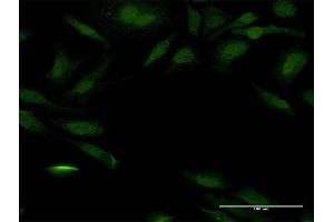 Immunofluorescence of purified MaxPab antibody to PEX14 on HeLa cell.