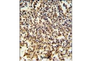 RNASEH2B Antibody (Center) (ABIN650970 and ABIN2840016) IHC analysis in formalin fixed and paraffin embedded human lymph tissue followed by peroxidase conjugation of the secondary antibody and DAB staining.