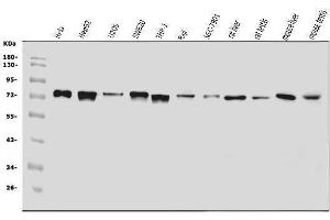 Western blot analysis of ADAMTS5 using anti-ADAMTS5 antibody (ABIN7602411).