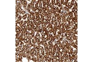 Immunohistochemical staining of human liver with ATP5B polyclonal antibody  shows strong cytoplasmic positivity in hepatocytes at 1:50-1:200 dilution.