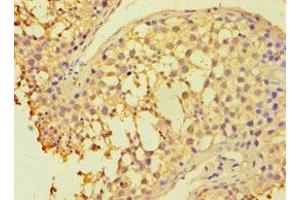Immunohistochemistry of paraffin-embedded human testis tissue using ABIN7154834 at dilution of 1:100 (HAUS3 anticorps  (AA 384-603))