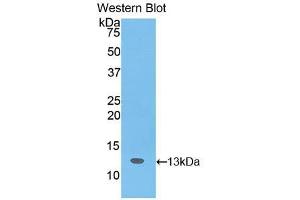 Western blot analysis of the recombinant protein. (SLIT3 anticorps  (AA 62-119))