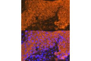 Immunofluorescence analysis of human skin using Cytokeratin 16 (KRT16) Rabbit mAb (ABIN7268094) at dilution of 1:100 (40x lens).