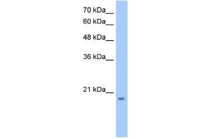 anti-MGC4172 (C-Term) antibody
