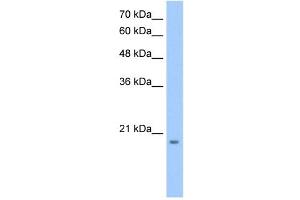 MGC4172 antibody used at 0. (MGC4172 (C-Term) anticorps)