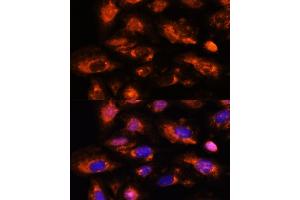 anti-2'-5' Oligoadenylate Synthetase 3 (OAS3) (AA 320-620) antibody