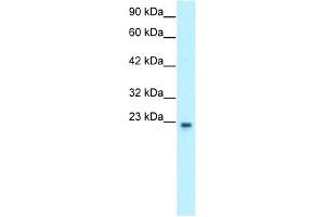 WB Suggested Anti-GTF2F2 Antibody Titration: 0.