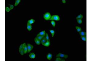 Immunofluorescence staining of HepG2 cells with ABIN7156637 at 1:100, counter-stained with DAPI. (IRF9 anticorps  (AA 44-180))
