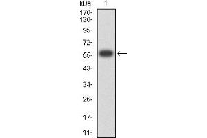 Western blot analysis using CD1B mAb against human CD1B (AA: extra 18-303) recombinant protein. (CD1b anticorps  (AA 18-303))