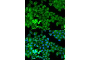 Immunofluorescence analysis of HeLa cells using JUP antibody. (JUP anticorps)