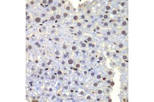 Immunohistochemistry of paraffin-embedded mouse liver using LHX4 antibody at dilution of 1:100 (x400 lens).