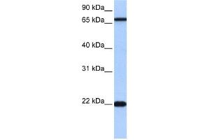 WB Suggested Anti-ACCSL Antibody Titration:  0. (ACCSL anticorps  (N-Term))