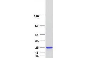 Validation with Western Blot