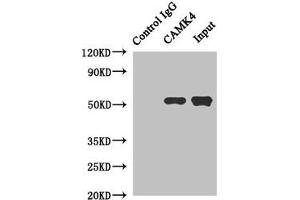 Immunoprecipitating CAMK4 in Jurkat whole cell lysate Lane 1: Rabbit control IgG instead of (1 μg) instead of ABIN7146449 in Jurkat whole cell lysate. (CAMK4 anticorps  (AA 304-473))