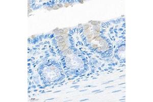 Immunohistochemistry of paraffin embedded rat colon using CNTROB (ABIN7073427) at dilution of 1:200 (400x lens) (CNTROB anticorps)