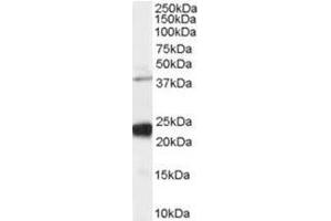 Image no. 1 for anti-GIPC PDZ Domain Containing Family, Member 1 (GIPC1) (C-Term) antibody (ABIN374381) (GIPC1 anticorps  (C-Term))