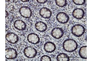 Immunoperoxidase of monoclonal antibody to EP300 on formalin-fixed paraffin-embedded human colon. (p300 anticorps  (AA 731-830))