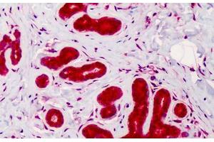 Human Breast: Formalin-Fixed, Paraffin-Embedded (FFPE) (Caspase 4 anticorps)