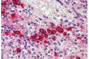 Anti-CD38 antibody  ABIN1048413 IHC staining of human spleen.