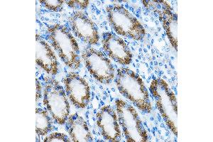 Immunohistochemistry of paraffin-embedded mouse kidney using MRPL13 Rabbit pAb  at dilution of 1:100 (40x lens).