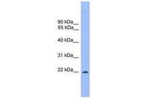 Image no. 1 for anti-Dorsal Root Ganglia Homeobox (DRGX) (AA 151-200) antibody (ABIN6744666) (DRGX anticorps  (AA 151-200))
