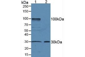 Western blot analysis of (1) Mouse Liver Tissue and (2) Mouse Skin Tissue. (Amphiregulin anticorps  (AA 20-100))