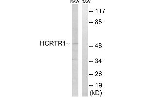 Western blot analysis of extracts from RAW264. (HCRTR1 anticorps)