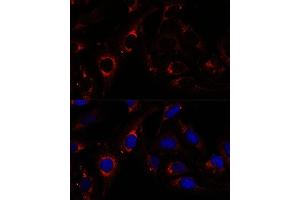 Immunofluorescence analysis of U-2 OS cells using RNF112 antibody (ABIN7270054) at dilution of 1:100.
