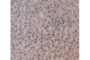 Used in DAB staining on fromalin fixed paraffin- embedded liver tissue (TOP2 anticorps  (AA 1079-1328))