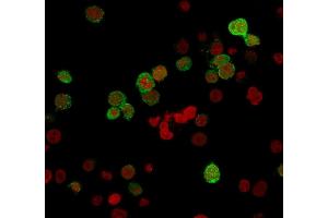 Immunofluorescence Analysis of PFA-fixed Jurkat cells labeled with ZAP70 Mouse Monoclonal Antibody (ZAP70/20535) followed by Goat anti-Mouse IgG-CF488 (Green).