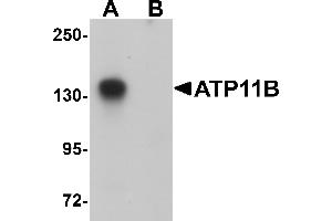 Western Blotting (WB) image for anti-ATPase, Class VI, Type 11B (ATP11B) (N-Term) antibody (ABIN1031250) (ATP11B anticorps  (N-Term))