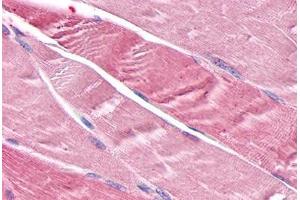 Anti-TNIK antibody  ABIN1049422 IHC staining of human skeletal muscle, myocytes. (TNIK anticorps  (Internal Region))