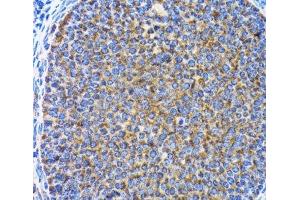 Immunohistochemistry of paraffin-embedded Rat ovary using MAP1LC3A Polyclonal Antibody at dilution of 1:100 (40x lens). (MAP1LC3A anticorps)