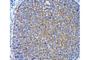 Immunohistochemistry of paraffin-embedded Rat ovary using MAP1LC3A Polyclonal Antibody at dilution of 1:100 (40x lens).