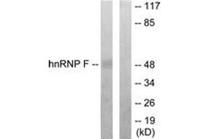 Western blot analysis of extracts from HepG2 cells, using hnRNP F Antibody. (HNRNPF anticorps  (AA 11-60))
