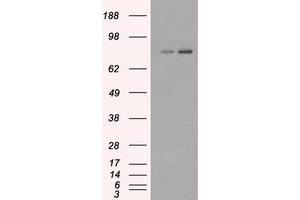 Image no. 1 for anti-Fermitin Family Member 2 (FERMT2) antibody (ABIN1499050) (FERMT2 anticorps)