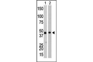 The anti-CKB Pab (ABIN391074 and ABIN2841221) is used in Western blot to detect CKB in Y79 cell lysate (Lane 1) and mouse colon tissue lysate (Lane 2). (CKB anticorps  (C-Term))