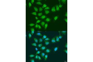 Immunofluorescence analysis of U2OS cells using EY antibody (ABIN7267073) at dilution of 1:100.